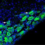 CHRNA9 Antibody in Immunohistochemistry (Frozen) (IHC (F))