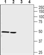 CHRNA9 Antibody in Western Blot (WB)