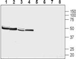 NMUR2 (extracellular) Antibody in Western Blot (WB)