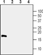 CDNF Antibody in Western Blot (WB)
