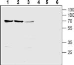 SLC28A1 Antibody in Western Blot (WB)