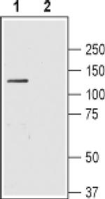 SLC4A4 (extracellular) Antibody in Western Blot (WB)