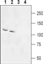 SLC4A5 Antibody in Western Blot (WB)