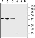 UCP2 Antibody in Western Blot (WB)