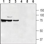 SLC47A1 Antibody in Western Blot (WB)
