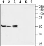 MRS2 Antibody in Western Blot (WB)