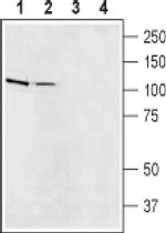 SLC9A5 Antibody in Western Blot (WB)