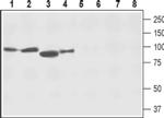 SLC8A2 Antibody in Western Blot (WB)