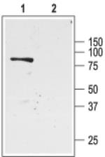 Kir1.1 (KCNJ1) Antibody in Western Blot (WB)