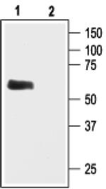 Kir3.1 (KCNJ3) Antibody in Western Blot (WB)