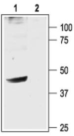 Kir3.2 (KCNJ6) Antibody in Western Blot (WB)