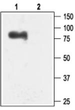 KCNN3 Antibody in Western Blot (WB)
