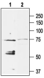 Kir3.4 (KCNJ5) Antibody in Western Blot (WB)