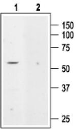 KCNK5 Antibody in Western Blot (WB)