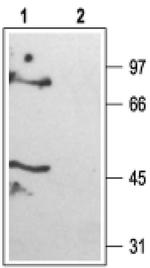 KCNK6 Antibody in Western Blot (WB)