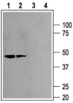 Kir2.2 (KCNJ12) Antibody in Western Blot (WB)