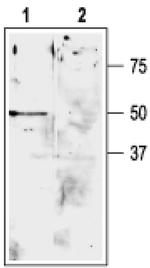 KCNK9 (extracellular) Antibody in Western Blot (WB)