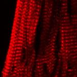 KCNE2 Antibody in Immunohistochemistry (Frozen) (IHC (F))