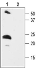 KCNE2 Antibody in Western Blot (WB)