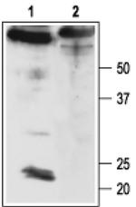 KCNMB4 Antibody in Western Blot (WB)