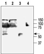 KCNN4 Antibody in Western Blot (WB)