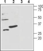 KCNMB3 (extracellular) Antibody in Western Blot (WB)