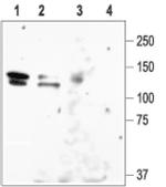 KCNH1 Antibody in Western Blot (WB)