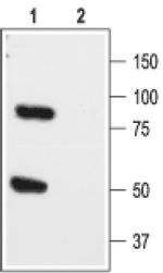 KCNK1 (extracellular) Antibody in Western Blot (WB)