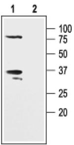 KVbeta2 (KCNAB2) Antibody in Western Blot (WB)