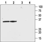 KVbeta2 (KCNAB2) Antibody in Western Blot (WB)
