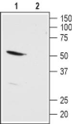 KCNK13 (extracellular) Antibody in Western Blot (WB)