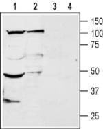 KCNK18 (extracellular) Antibody in Western Blot (WB)
