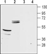 Kir5.1 (KCNJ16) Antibody in Western Blot (WB)