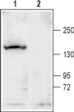 KCNT1 Antibody in Western Blot (WB)