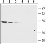 Kir7.1 (KCNJ13) (extracellular) Antibody in Western Blot (WB)