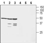 KVbeta1 (KCNAB1) Antibody in Western Blot (WB)
