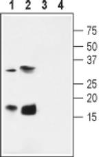 KCNE4 Antibody in Western Blot (WB)
