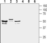 KCNF1 Antibody in Western Blot (WB)