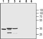 KChIP3 Antibody in Western Blot (WB)