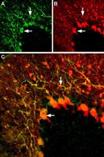 KV1.5 (KCNA5) (extracellular) Antibody in Immunohistochemistry (IHC)