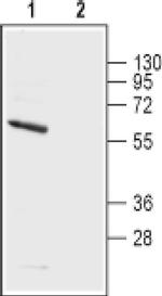 KV1.5 (KCNA5) (extracellular) Antibody in Western Blot (WB)