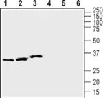 KCNE1 Antibody in Western Blot (WB)