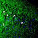 P2X2 Antibody in Immunohistochemistry (IHC)
