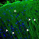 P2X2 Antibody in Immunohistochemistry (IHC)