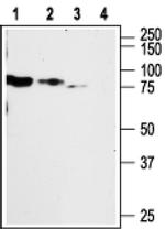 P2X2 Antibody in Western Blot (WB)