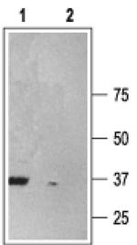 P2X6 Antibody in Western Blot (WB)