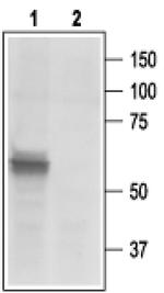 P2X3 Antibody in Western Blot (WB)