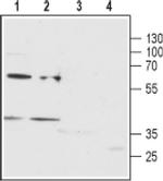 P2Y12 (extracellular) Antibody in Western Blot (WB)