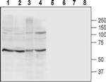 P2X4 (extracellular) Antibody in Western Blot (WB)