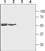 P2X5 (extracellular) Antibody in Western Blot (WB)